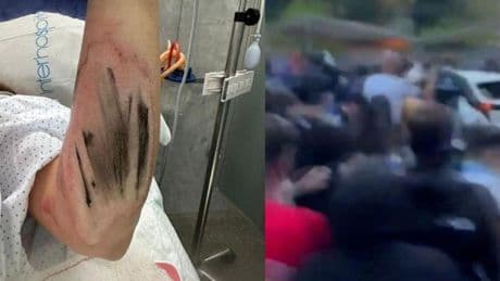 Rompe su silencio la primera víctima del atropello masivo antes del derbi: "Tuvieron que intervenirme de urgencia y cambiarme de hospital"