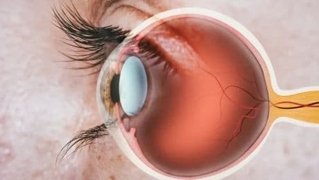 Qué son los nevus o lunares de ojos: los tres signos que deberías revisar, según asegura un oftalmólogo