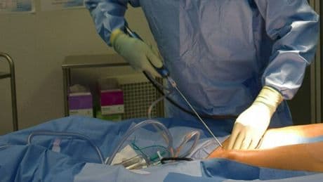 Liposuzione, cos'è l'intervento chirurgico a cui è stata sottoposta la 47enne morta a Roma: procedura e rischi