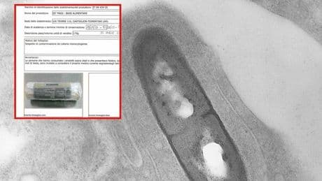 Listeria, prodotti ritirati in Italia per sospetta contaminazione: ecco quali sono. Sintomi, diagnosi e cosa sapere
