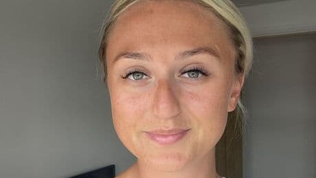 Holidaymaker 'horrifically burned as Shein top reacts with suncream’