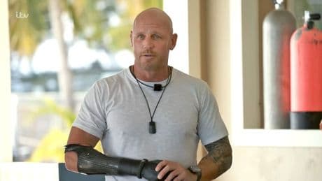 ‘A shark ate my arm and leg – I wouldn’t change a thing’