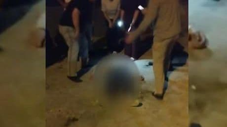 Eski nişanlısının elinde bıçak gören kadın kendisini balkondan attı