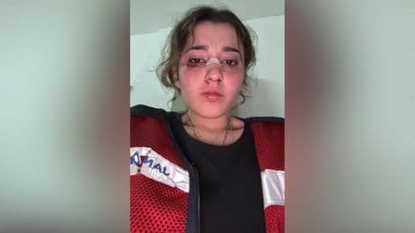 Yalova'da erkek vahşeti: Nişanlısını kaskla darp etti, ölüm tehditleri savurdu