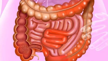 „Dann haben wir einen großen Schritt in der Therapie geschafft“