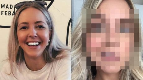 I Took My Appearance For Granted. Then My Face Changed And My Life Transformed Overnight
