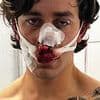 New York model horrifically disfigured after protecting two women from knifeman while vacationing in Germany