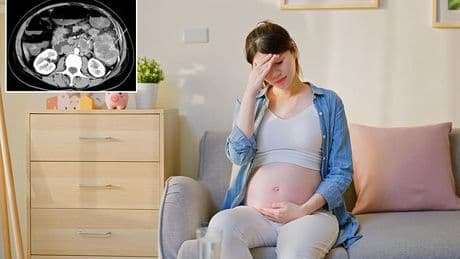 I thought my stomach pain was from giving birth... it was actually an aggressive form of colon cancer