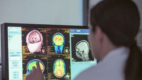 Aufbruch in der Medizin: Neuer Chip verspricht Linderung für Parkinson-Patienten