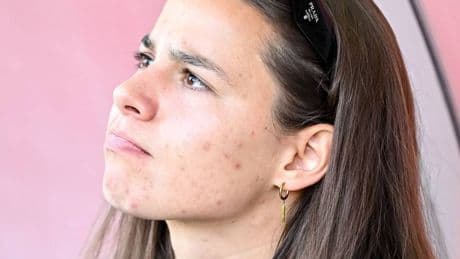 „Die EM kommt zu früh für sie“: Hängepartie vorbei – DFB-Team fährt ohne Lena Oberdorf in die Schweiz