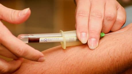 Descubren una terapia low cost que reduce el colesterol en un 50% en solo tres días