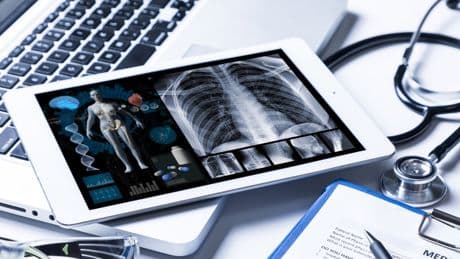 Tumore della vescica: un cerotto medicato interno cambia il futuro delle cure