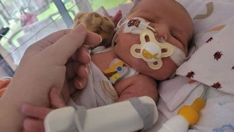 'My baby was born with a fatal illness but a tiny umbrella saved his life'