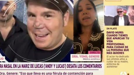 Lucas, de Andy y Lucas, sorprende con un nuevo cambio en su nariz: "Degeneración estética"