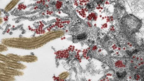 Descubren una nueva forma de aprendizaje del cerebro basada en el método del ensayo y error