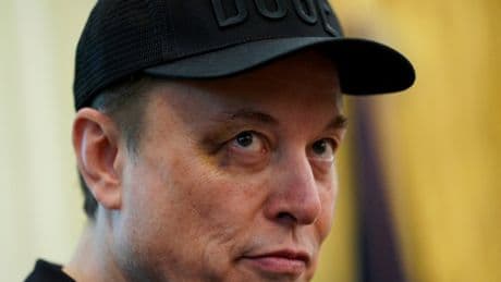 Elon Musk shows up with black eye to Trump’s event bidding him farewell