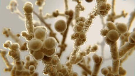 Health chiefs issue warning as drug-resistant fungus which kills 60% of infected sweeps through hospitals
