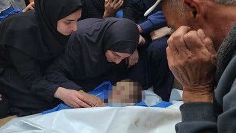 Annesinin 700 iğne vurularak doğurduğu Gazzeli bebeği İsrail bombayla katletti