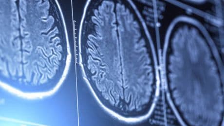 Your brain could get bigger – not smaller – as you age. Here’s what we know