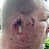 Dog-minder has ear ripped off by XL Bully after it attacked him while he slept