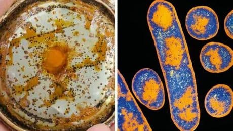 Botulino: i sintomi (della vista e gusto), il colore o l'odore "innaturali" e come riconoscere i segnali di alterazione dei cibi