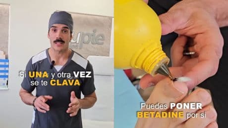 Héctor Alonso, podólogo: “Este truco con algodón puede evitar que tu uña encarnada vuelva a clavarse nunca más”