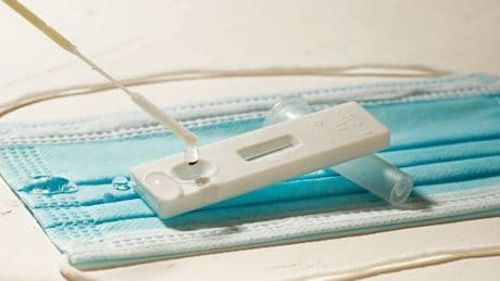 776 jours de tests positifs: comment un patient a vécu avec le Covid-19 pendant plus de deux ans, un record