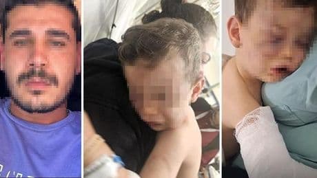 2 yaşındaki Aren'e işkencede korkunç detaylar! Anne ve sevgilisi gözaltında