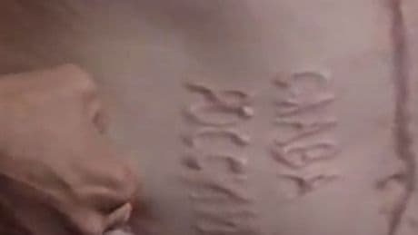 Ukrainian prisoner of war branded with words ‘Glory to Russia’ reveals horror ordeal
