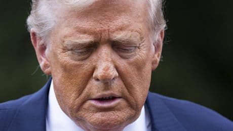 Donald Trump lijdt aan aderziekte: hoe staat het er écht voor met zijn gezondheid?