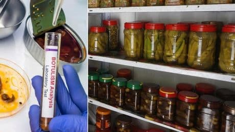 Botulino, il pericolo invisibile celato nelle conserve sott?olio. Sicuri sughi e marmellate