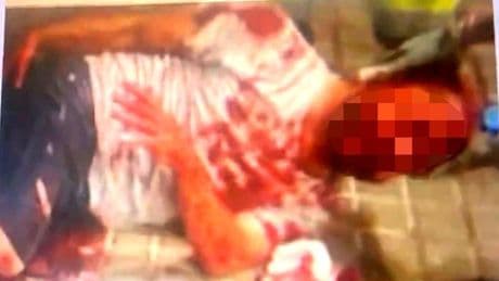 El policía nacional en la UCI salía de un cumpleaños cuando fue agredido: un "currante" destinado en Elche