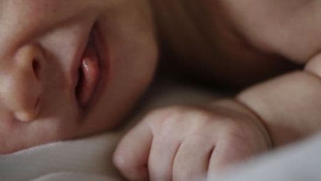 Scotland first part of the UK to screen babies for ‘devastating’ rare condition