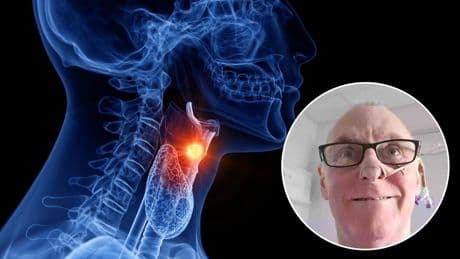 Frank (60 años), enfermo de cáncer de garganta por practicar sexo oral, tajante: "No lo vuelvo a hacer ni con Demi Moore"