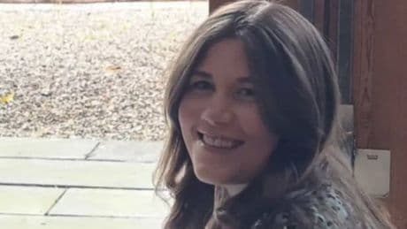 Hidden condition leaves woman with broken teeth and burns on her face