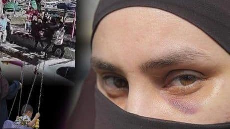 Parka giden kadın çocuklarının önünde darbedildi