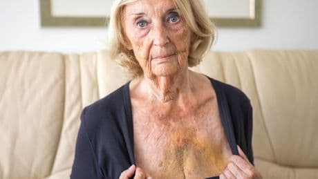 Ute (81) über bösen Zoff am Gartenzaun - „Mein Nachbar hat mich so zugerichtet“