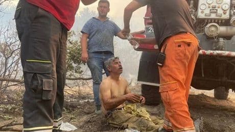 Yangında yaralanan orman işçisi yoğun bakımda!