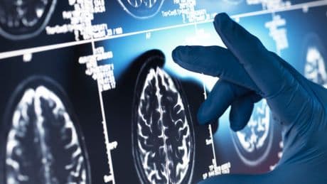Breakthrough ultra-rapid test that can diagnose brain tumours in just two hours could be rolled out on NHS in a year