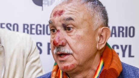 Pepe Álvarez aparece en un acto de UGT con la cara llena de heridas: "Ayer por la mañana me caí de la bicicleta"