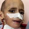 Kleine Amr (3) vecht voor zijn leven nadat hij granaatscherven in hoofd kreeg bij Israëlische aanval die zijn familie doodde