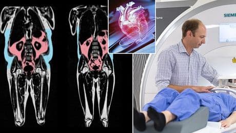 'Hidden' fat is silently ageing you - one common body shape is most at risk, scientists warn