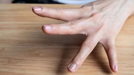 Lung cancer doctors say early sign of disease can appear on your fingertips