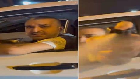 Üsküdar'da yol verme kavgası! Yüzüne biber gazı sıkılan kadın görme kaybı yaşadı