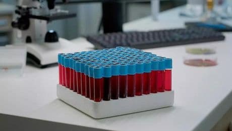 ¿Qué es la sangre dorada y por qué es una maldición para quien la posee?