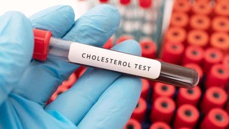 Shop-bought health tests not always fit for purpose, researchers warn