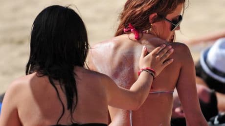 Que faire en cas de coup de soleil chez l'enfant ou l'adulte?