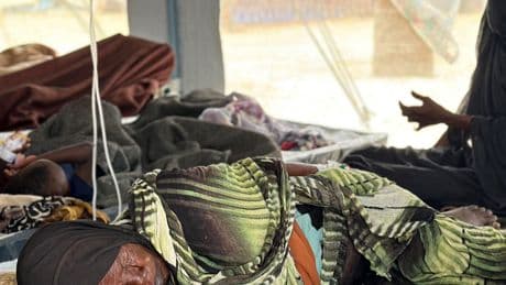 Sudan Hit by Its ‘Worst Cholera Outbreak’ in Years, Medical Charity Says