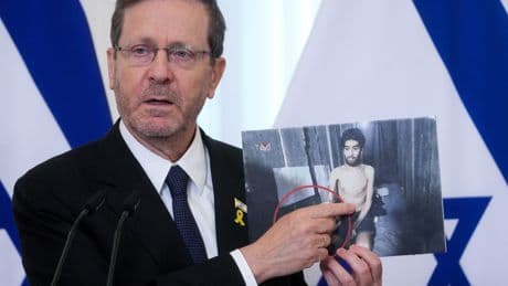 Shame on those who don’t care about starving Israeli hostages