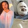 California woman disfigured after suffering freak accident while making s'mores on outdoor fire pit